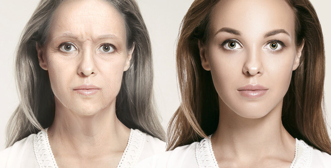 Odkryj najskuteczniejsze metody opóźniania procesów starzenia, takie jak laseroterapia, HIFU i biostymulatory. Zachowaj młodszy wygląd skóry dzięki nowoczesnym zabiegom medycyny estetycznej.