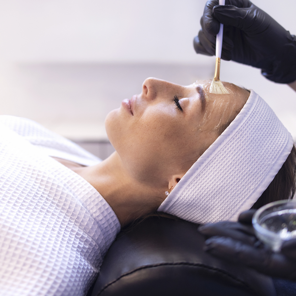 Zabieg peelingu chemicznego wykonywany w gabinecie medycyny estetycznej dla poprawy kondycji skóry.