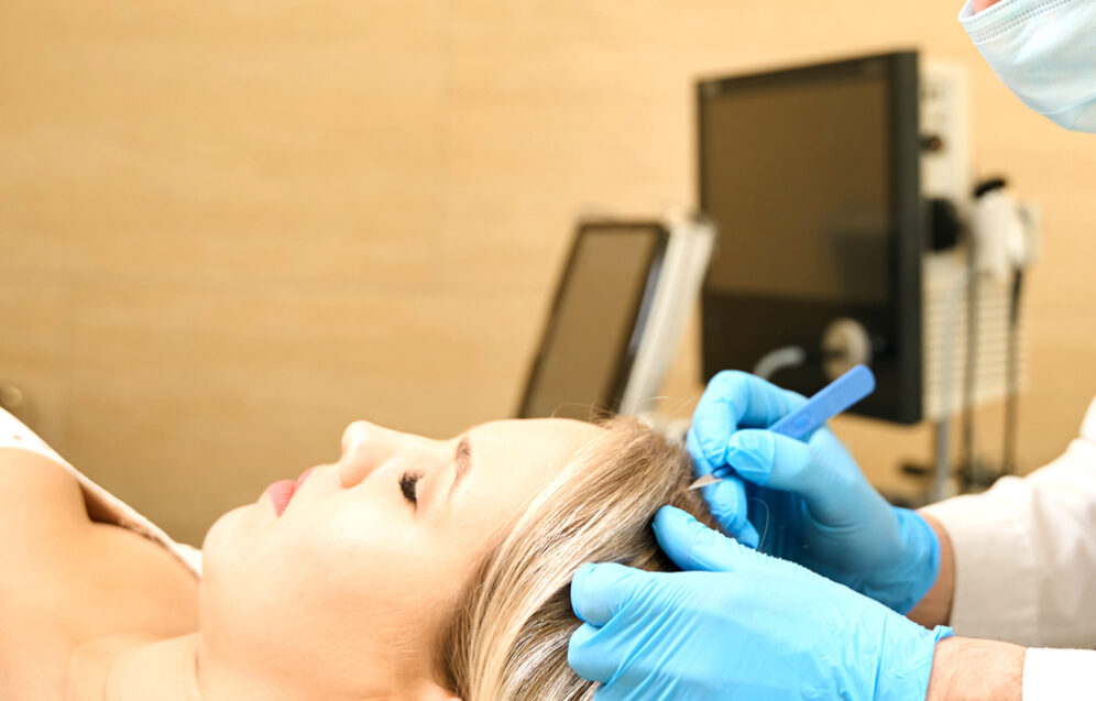 Nowoczesne metody przeszczepu włosów – innowacyjne techniki i ich efektywność w poprawie wyglądu. Chirurgia plastyczna Wrocław.