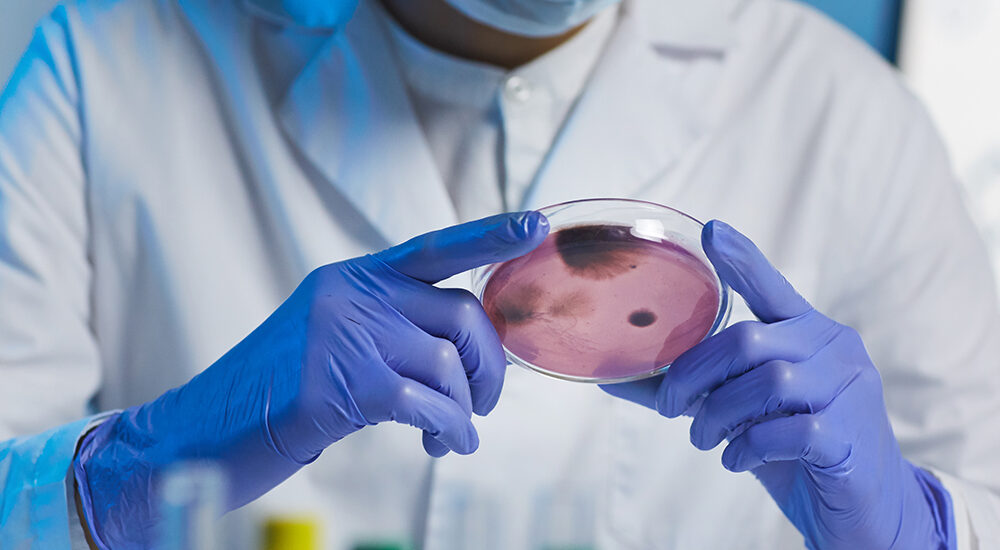 Komórki macierzyste w chirurgii plastycznej – przyszłość regeneracji skóry