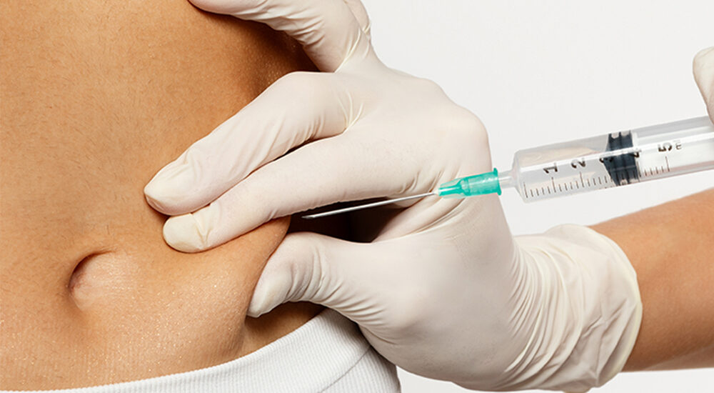 Chirurgia plastyczna po utracie wagi – wyzwania związane z nadmiarem skóry i możliwości poprawy sylwetki. Chirurgia plastyczna Wrocław.