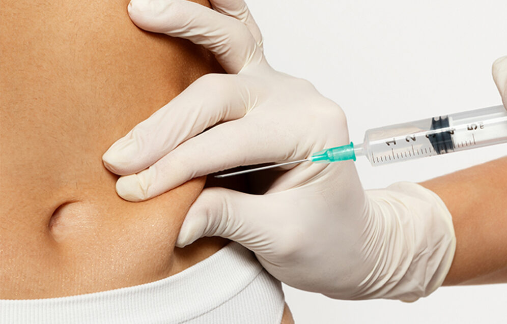 Chirurgia plastyczna po utracie wagi – wyzwania związane z nadmiarem skóry i możliwości poprawy sylwetki. Chirurgia plastyczna Wrocław.