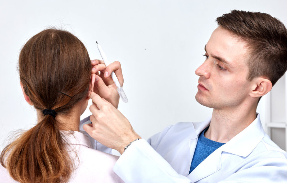 Zdjęcie przedstawia zabieg otoplastyki - chirurgii uszu który poprawia wygląd uszu, modelując je w sposób, który przywraca równowagę i harmonię twarzy.