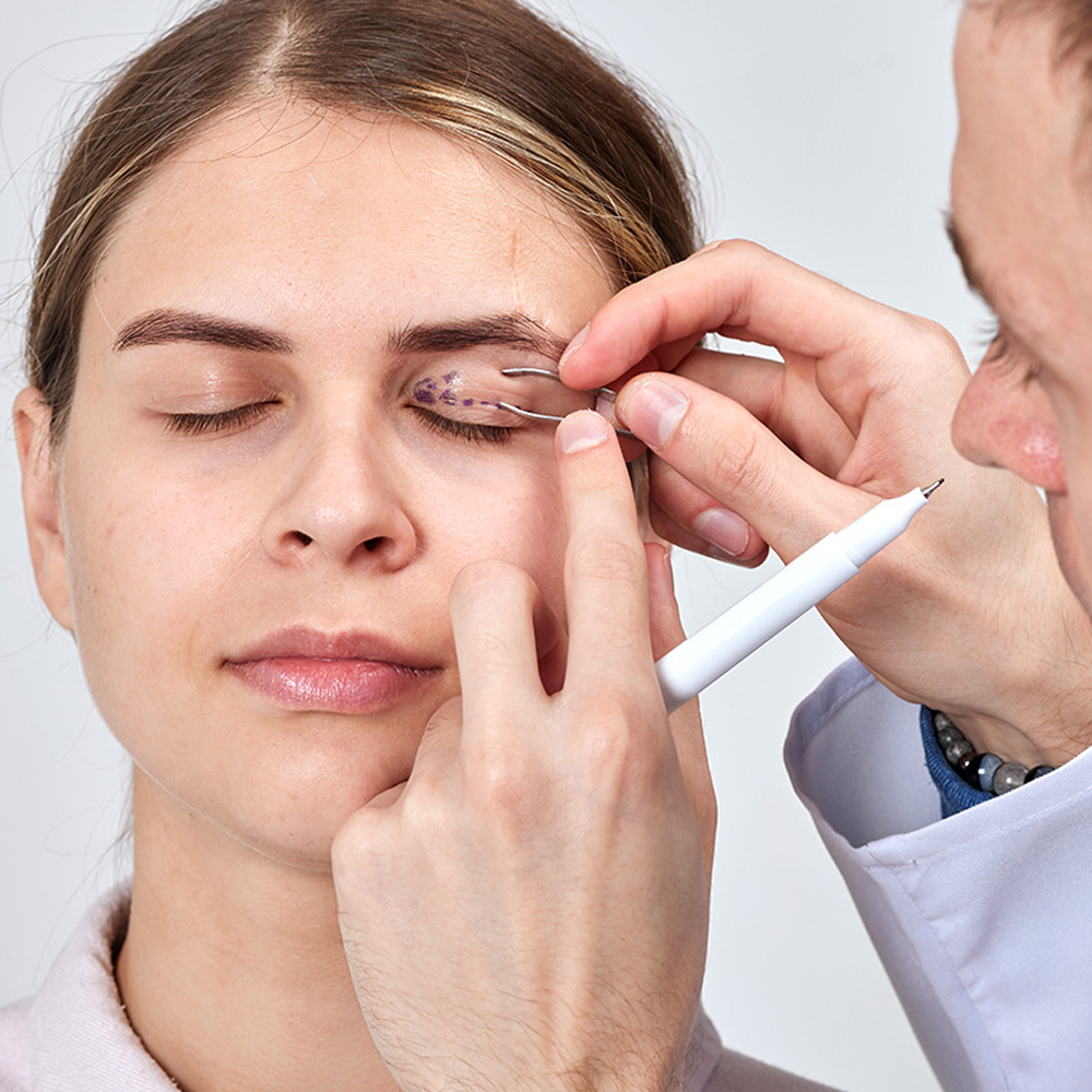 Chirurgia powiek (blefaroplastyka) – zabieg poprawiający wygląd i funkcję powiek.