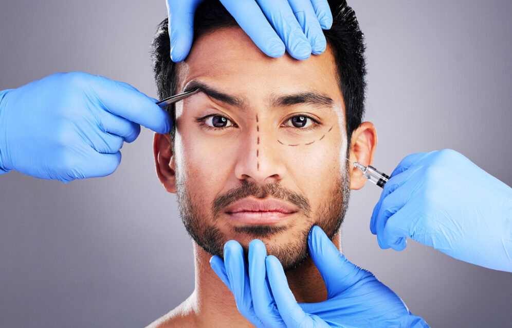 Zdjęcie przedstawia zabieg rekonstrukcji twarzy, który pomaga przywrócić estetykę i funkcjonalność twarzy po urazach lub deformacjach.