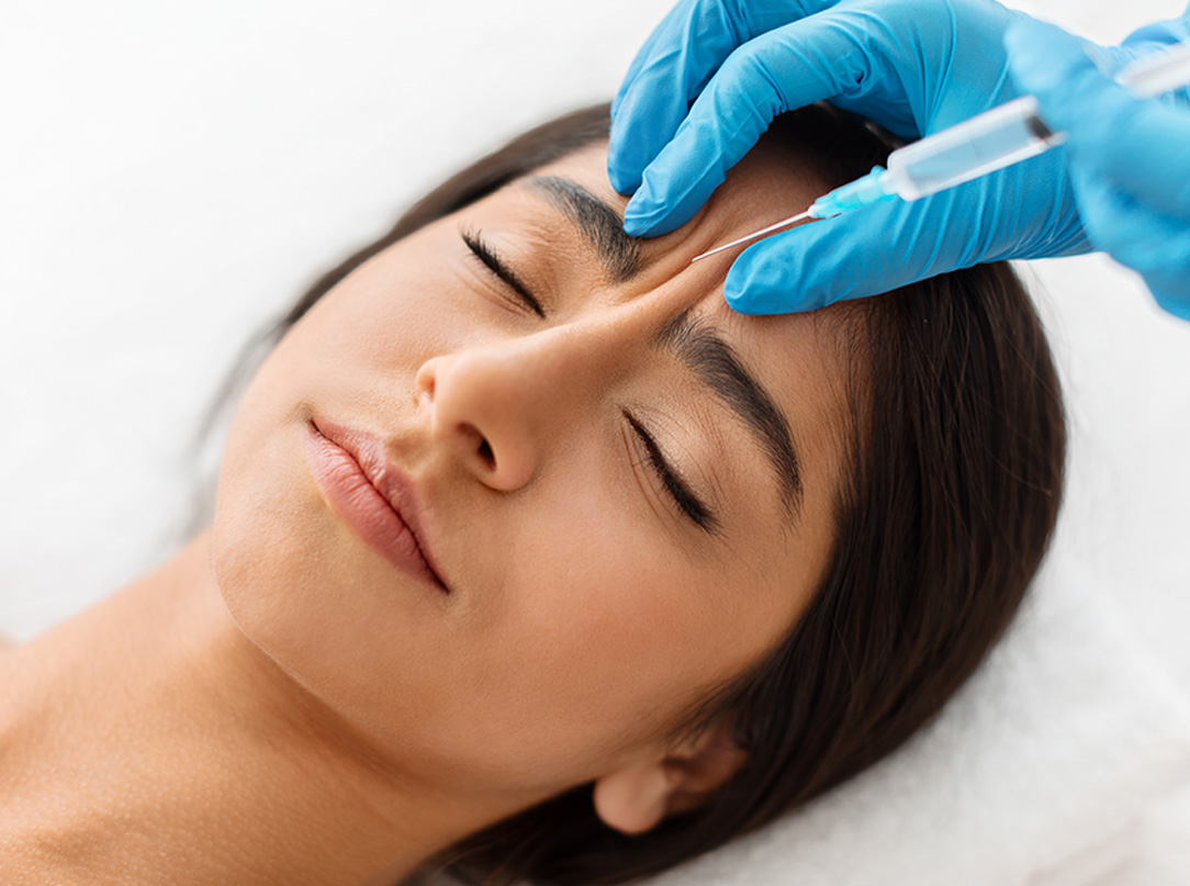 Zdjęcie przedstawia zabieg z wykorzystaniem toksyn botulinowych, który skutecznie redukuje zmarszczki mimiczne i poprawia estetykę skóry.