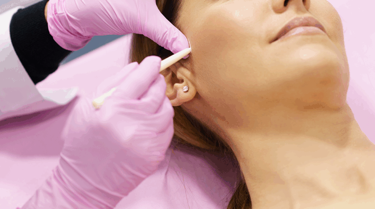 korekcja odstających uszu