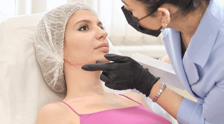 liposukcja podbródka