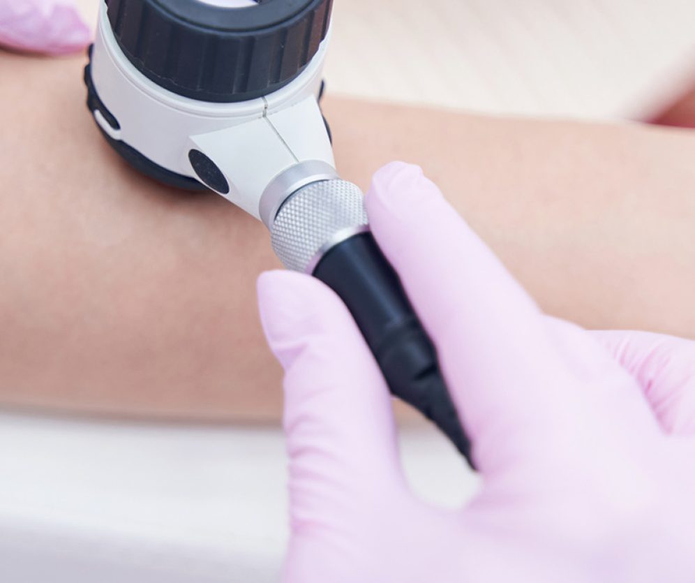 dermatologia-wroclaw-dermatoskopia-ocena-znamion-3