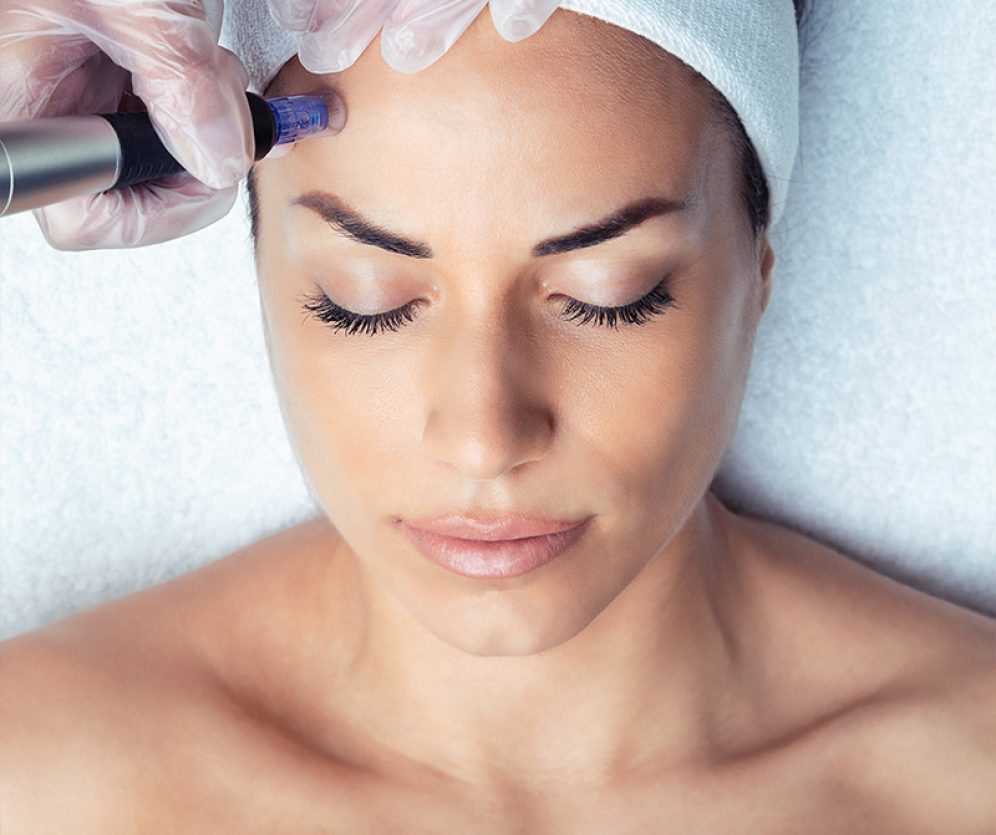 medycyna-estetyczna-wroclaw-dermapen-3