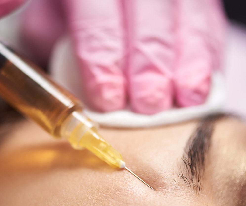 medycyna-estetyczna-wroclaw-leczenie-mezoterapia-3