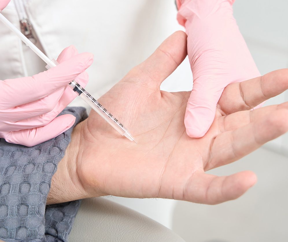 ortopedia-wroclaw-operacja-palca-strzelajacego-3